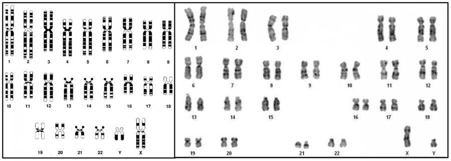 cromossomos humanos na citogenética