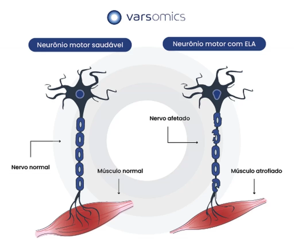 esquema de representação dos efeitos da ELA nos neurônios musculares