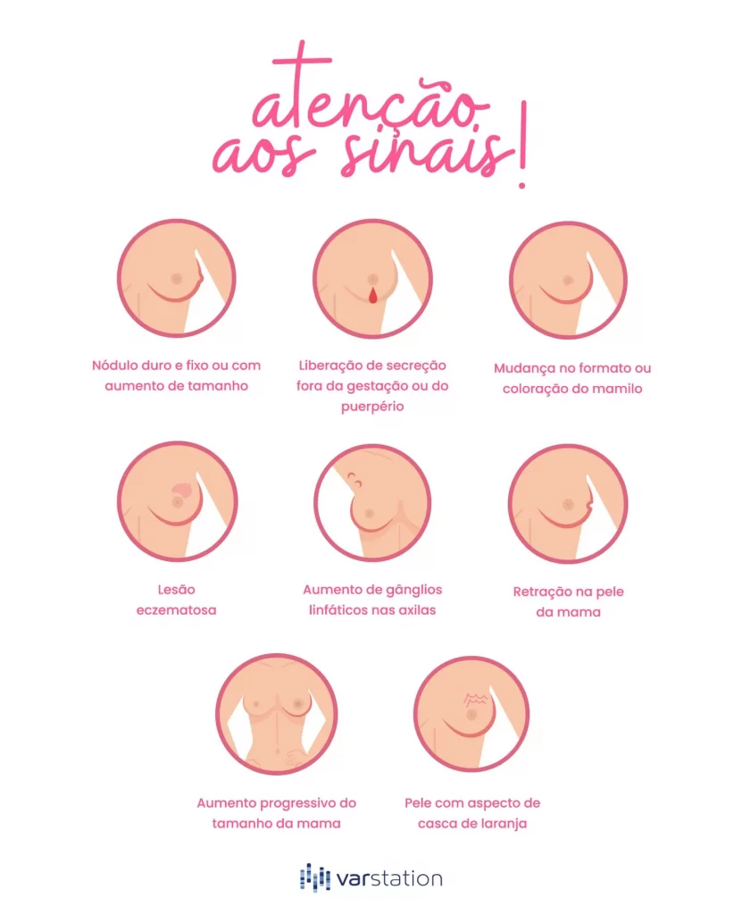 sinais de câncer de mama ilustração