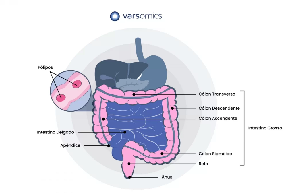 cancer de intestino anatomia do órgão